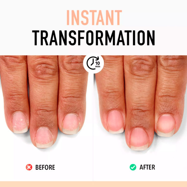 Nail Probiotic Instant Boost – Image 2